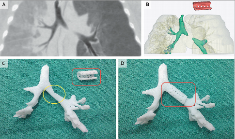 La tecnologia di 3D printing al servizio della medicina La tecnologia di 3D printing al servizio della medicina