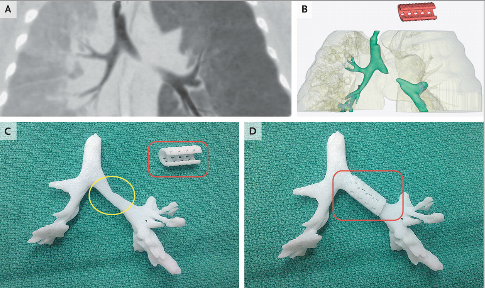 La tecnologia di 3D printing al servizio della medicina