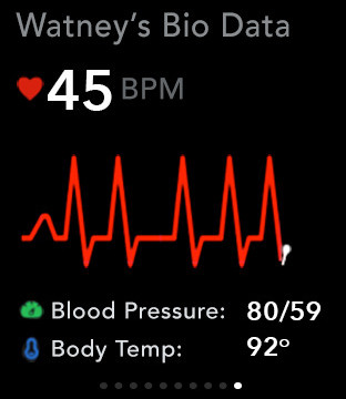 Sopravvissuto – The Martian 11