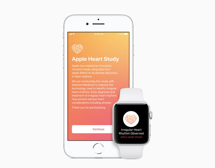 Apple Heart Study