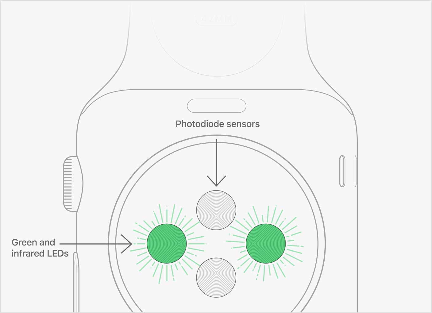 Apple Watch, uomo salvato dopo la segnalazione di anomalie nel suo battito cardiaco