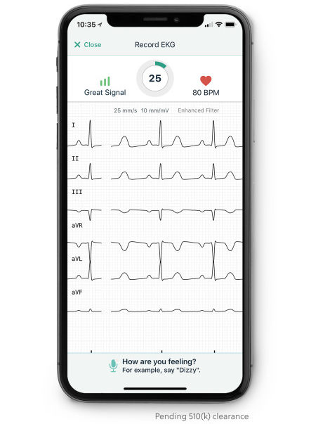 AliveCor sfida Apple Watch 4 con l’ECG a sei derivazioni diagnostiche EKG