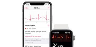 Con watchOS 5.1.2 sarà attiva l’app ECG su Apple Watch Series 4