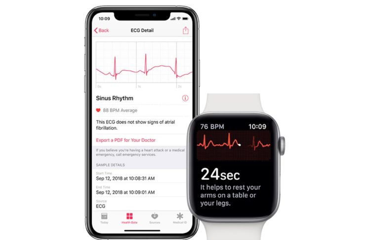 Con watchOS 5.1.2 sarà attiva l’app ECG su Apple Watch Series 4