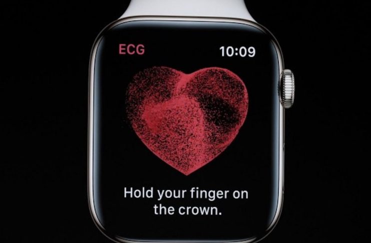 Apple accetterà restituzioni di Apple Watch fino a 45 giorni