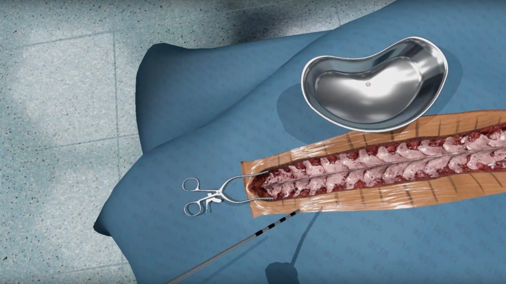 A scuola di chirurgia con la realtà aumentata e un Mac: il progetto di Fundamental VR