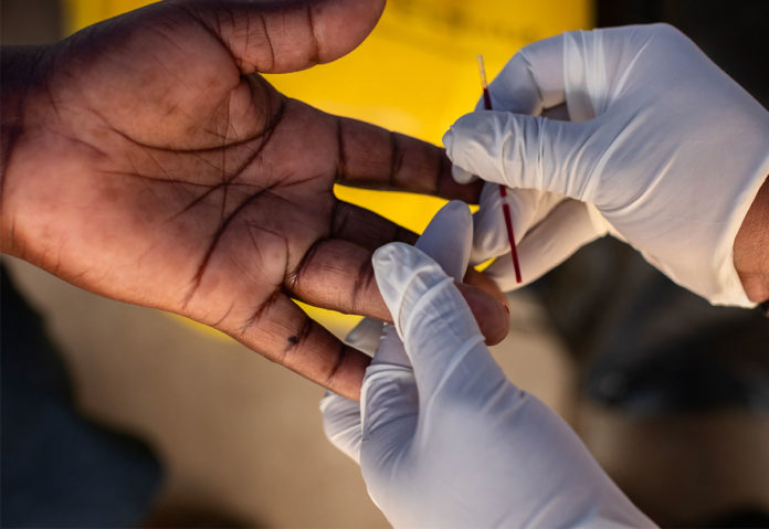 Bastano 15 minuti per il test rapido dell’HIV con un campione di sangue.