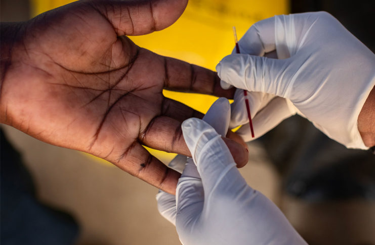 Bastano 15 minuti per il test rapido dell’HIV con un campione di sangue.