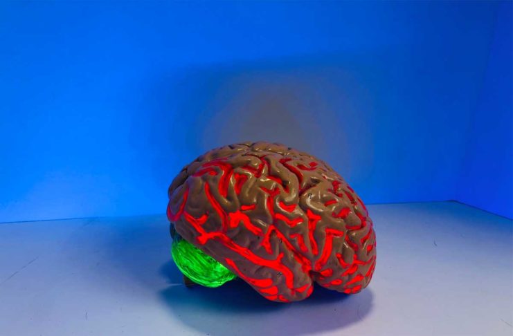 Creato un sistema AI in grado di predire accuratamente le crisi epilettiche