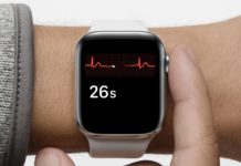 Prevenzione della fibrillazione atriale con Apple Watch: più di 4.300 ECG in due giorni