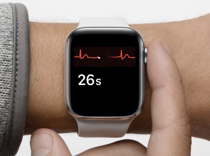 Prevenzione della fibrillazione atriale con Apple Watch: più di 4.300 ECG in due giorni