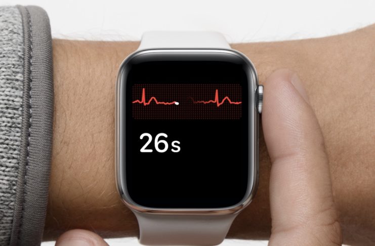 Prevenzione della fibrillazione atriale con Apple Watch: più di 4.300 ECG in due giorni