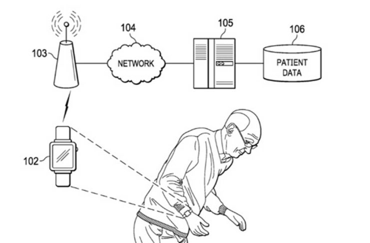 In futuro l’Apple Watch come aiuto nel trattamento del morbo di Parkinson