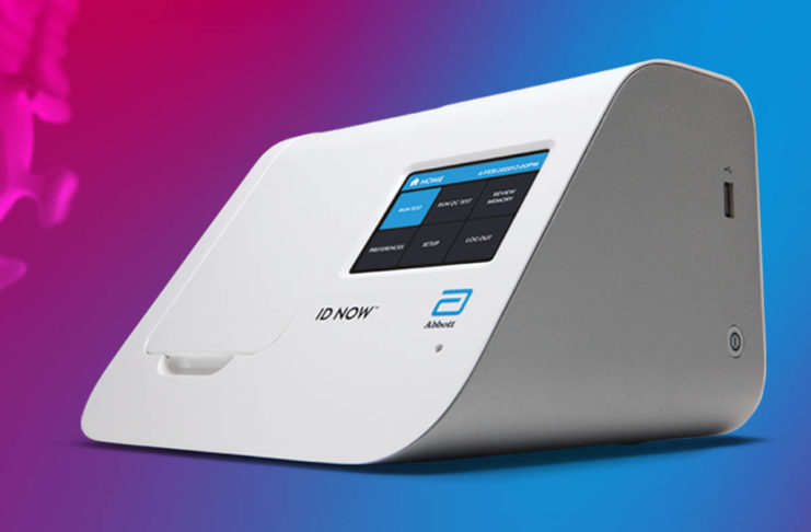 COVID-19, una tecnologia promette il test in 5 minuti e non serve un laboratorio