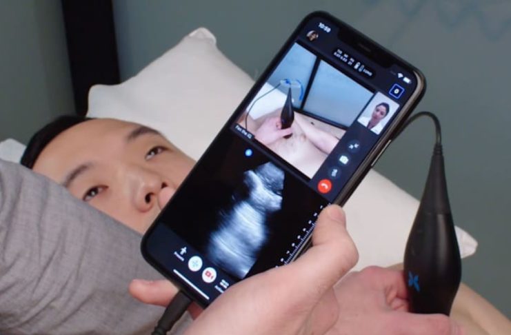 iPhone e Butterfly iQ possono rilevare Covid-19 a distanza