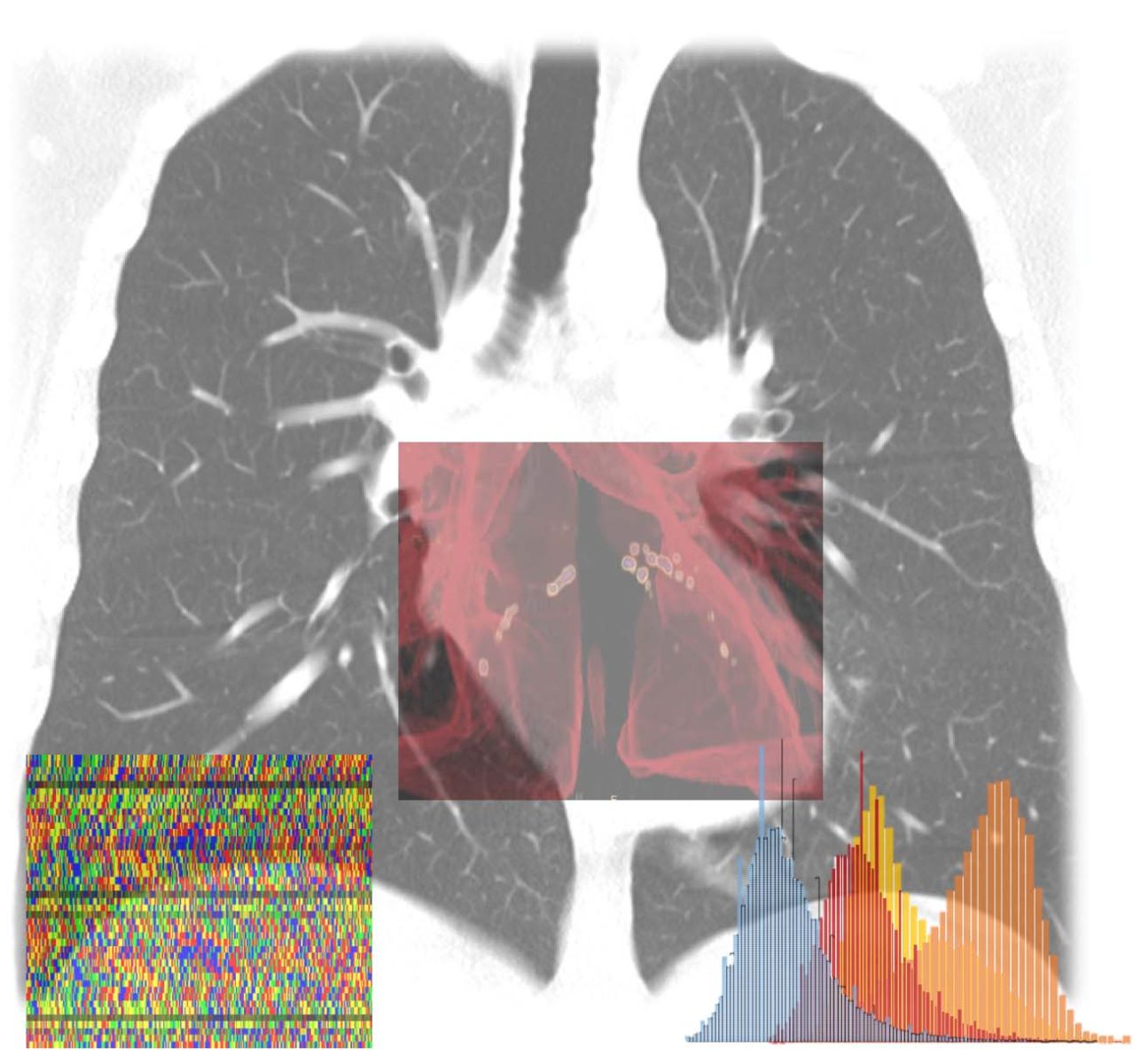 AI-SCoRE, piattaforma per calcolare il rischio da Covid-19