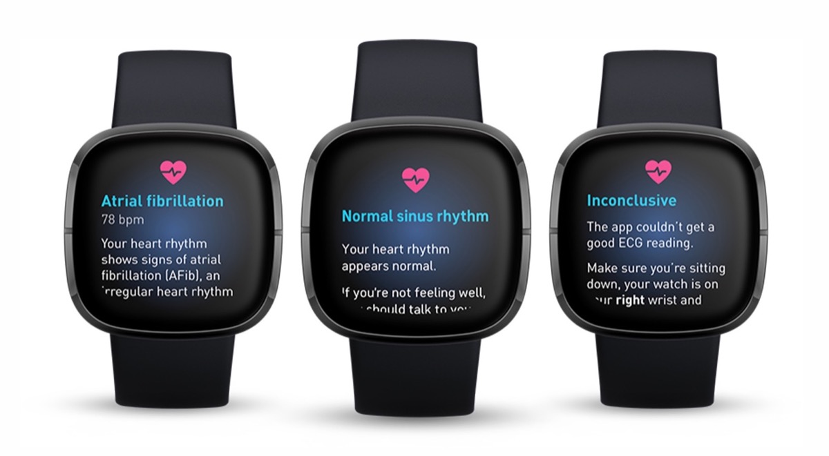 Ora l’ECG del Fitbit Sense funziona anche in Italia