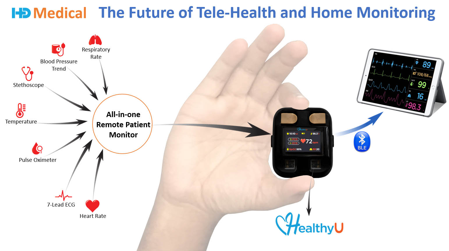 HealthyU, un dispositivo per il monitoraggio smart dei pazienti tutto in uno per la telemedicina e il benessere