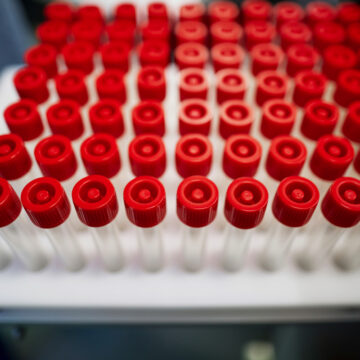 Grazie ad Apple creati milioni di test Covid-19 in USA