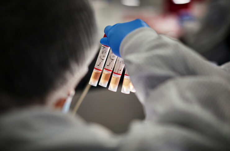 Grazie ad Apple creati milioni di test Covid-19 in USA