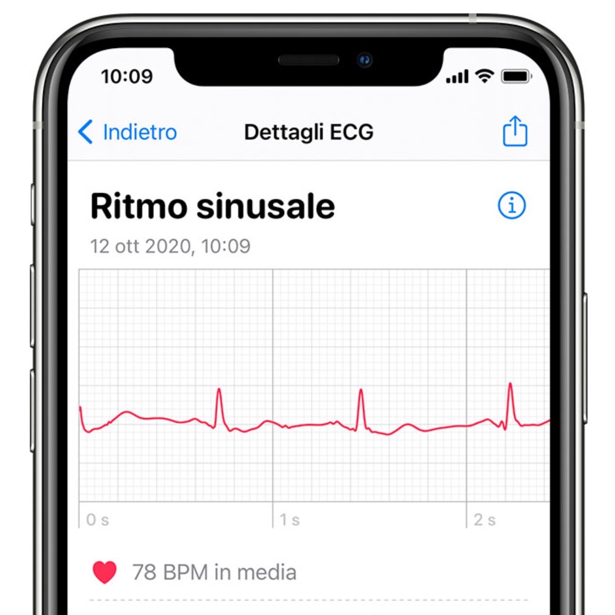 L’Australia approva la funzione ECG di Apple Watch L’Australia approva la funzione ECG di Apple Watch