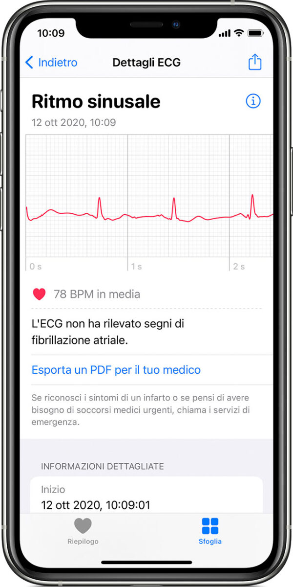 Apple: causa perché non consente a terze parti analisi del ritmo cardiaco su Apple Watch Apple: causa perché non consente a terze parti analisi del ritmo cardiaco su Apple Watch