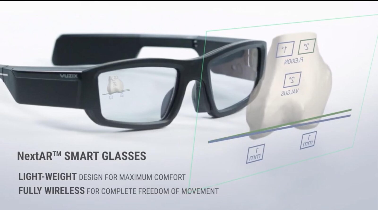 A Parma intervento di chirurgia protesica alla spalla con Realtà Aumentata