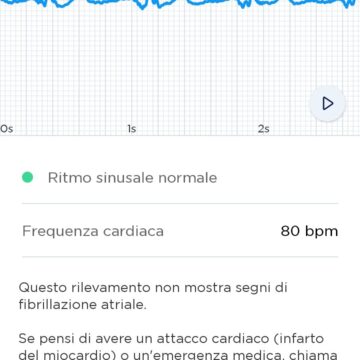 Recensione Withings ScanWatch, il miglior ibrido in campo clinico