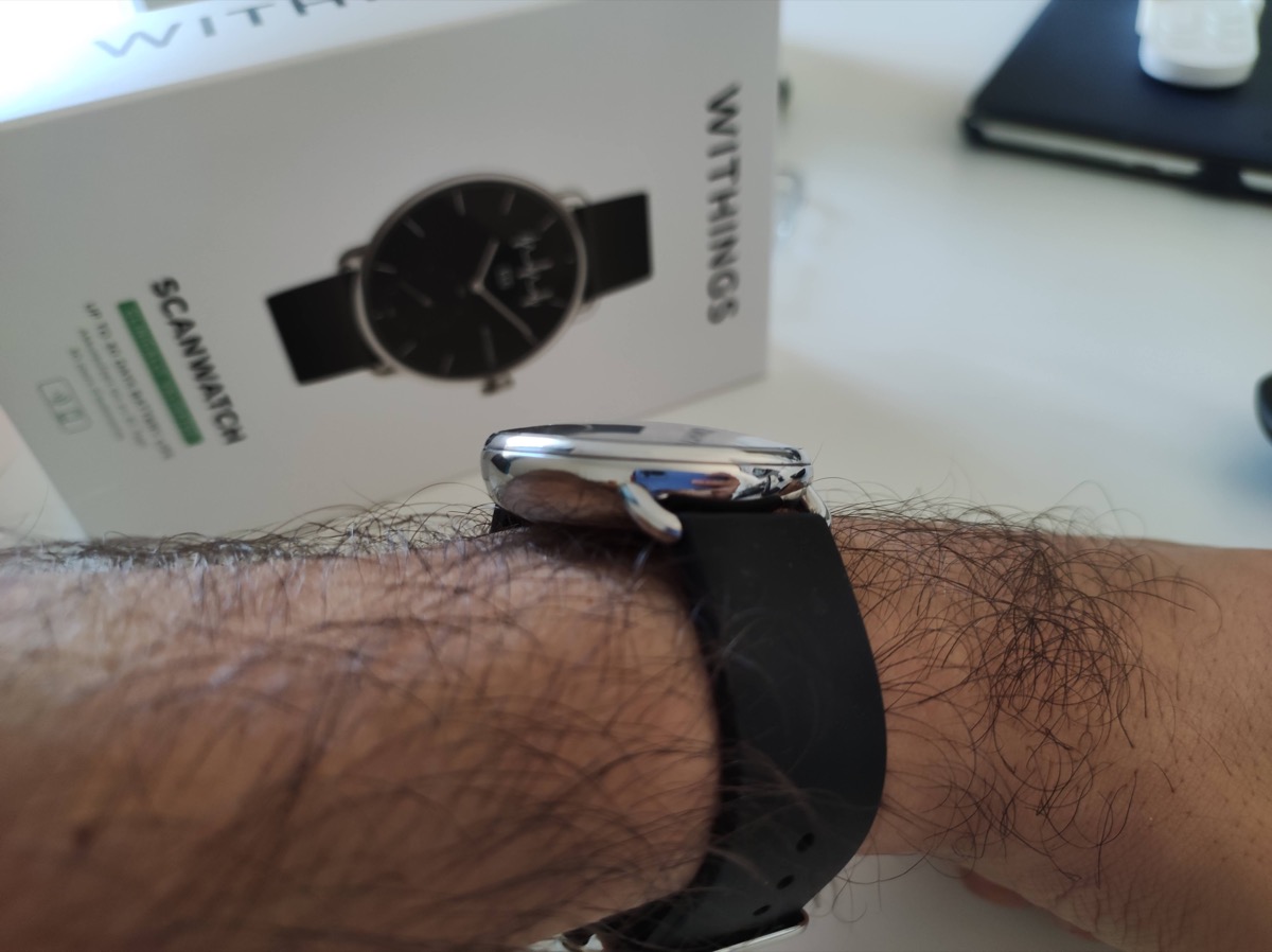 Recensione Withings ScanWatch, il miglior ibrido in campo clinico