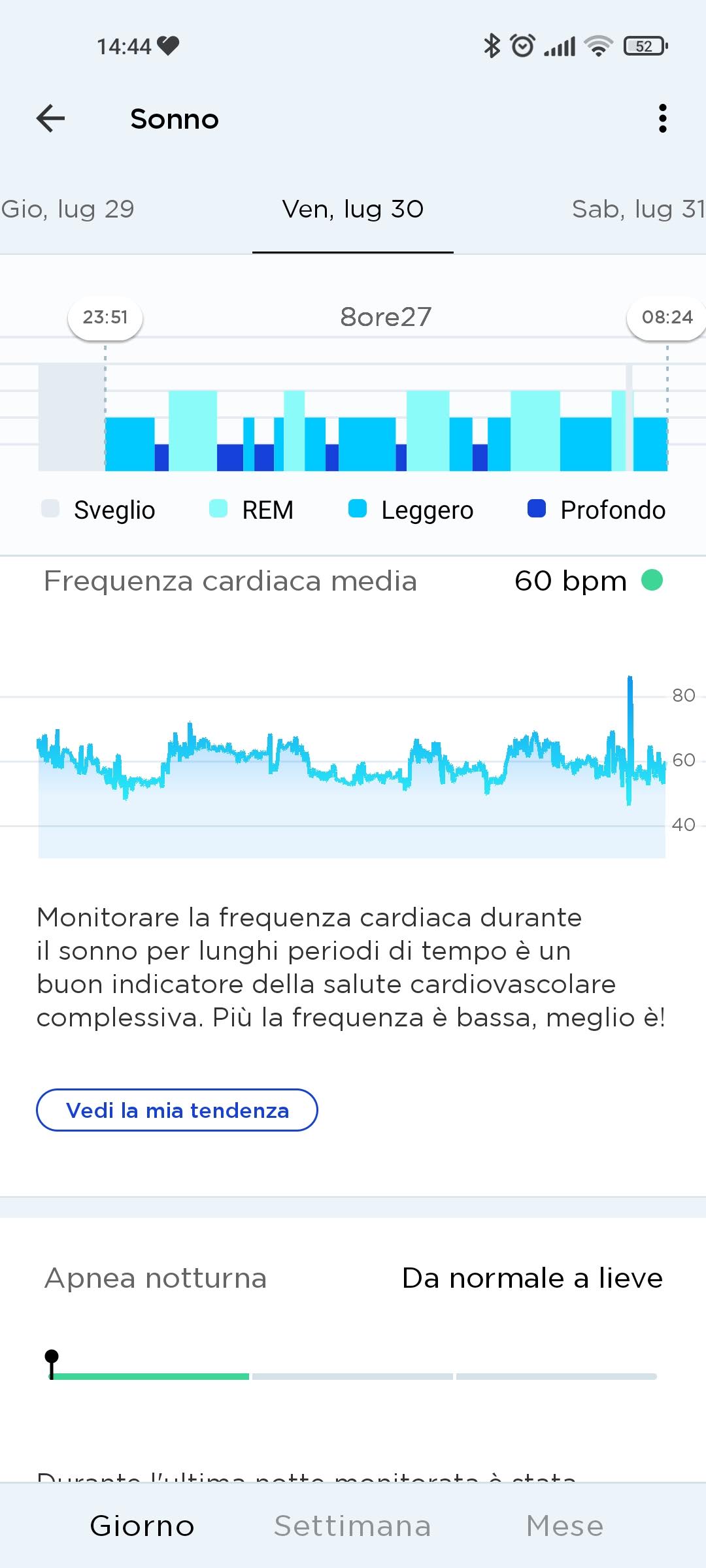 Recensione Withings Sleep Analyzer
