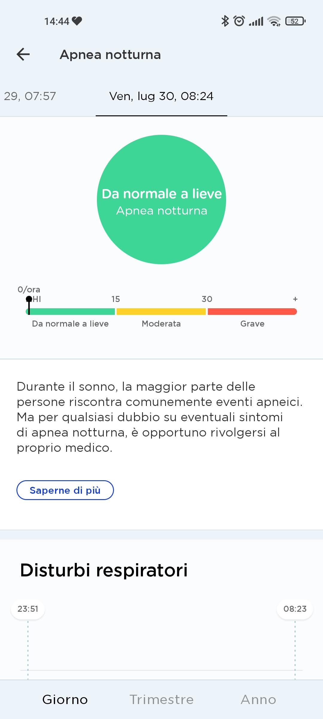 Recensione Withings Sleep Analyzer