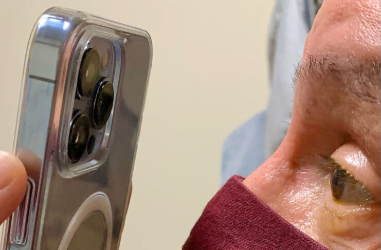 Medico usa la fotocamera di iPhone 13 Pro per scattare foto macro degli occhi dei pazienti