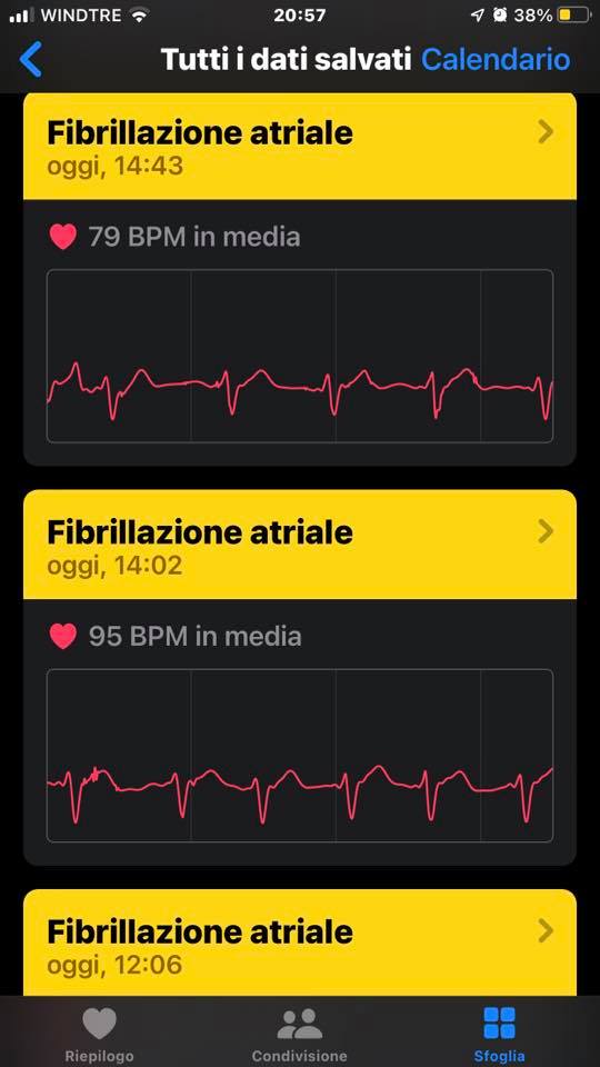 Eugenio Finardi: “Salvato dall’Apple Watch che ha segnalato Fibrillazione Atriale” Eugenio Finardi: “Salvato dall’Apple Watch che ha segnalato Fibrillazione Atriale”