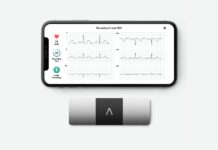 Apple andrà a processo per le app che rilevano il battito cardiaco