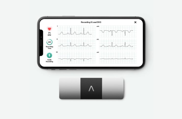 Apple andrà a processo per le app che rilevano il battito cardiaco