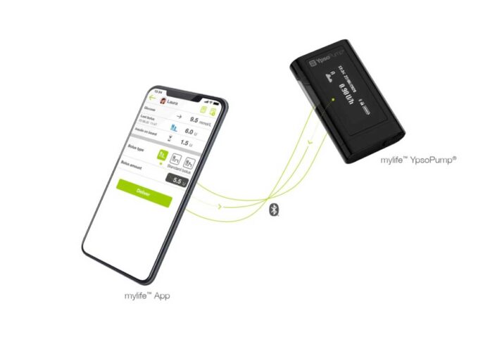 Diabete tipo 1, un’app per somministrare in remoto l’insulina da smartphone