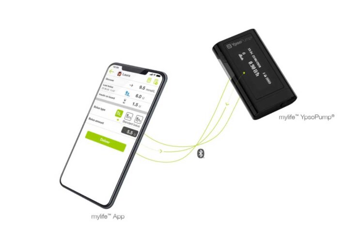 Diabete tipo 1, un’app per somministrare in remoto l’insulina da smartphone