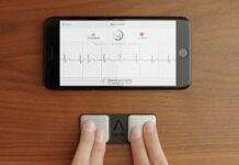 Apple accusa AliveCor di violazione di brevetti
