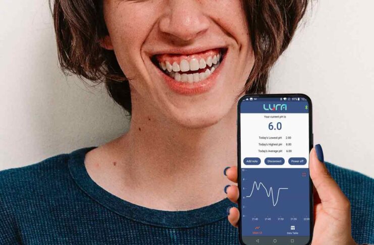 Un sensore per i denti in grado di analizzare la saliva in tempo reale