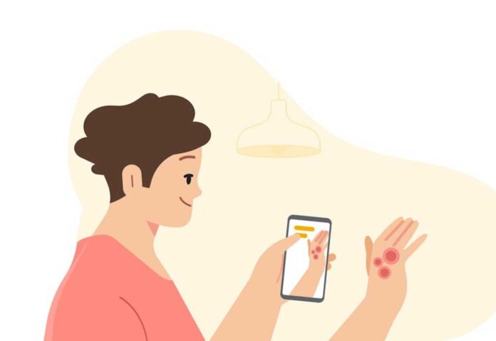 L'app Google Lens permette di individuare potenziali malattie della pelle