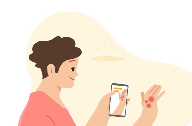 L'app Google Lens permette di individuare potenziali malattie della pelle