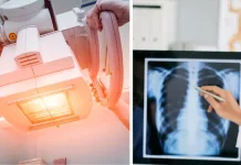 Salute, il progetto TraMeXi promette di ridurre esposizione dei pazienti ai raggi X