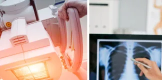 Salute, il progetto TraMeXi promette di ridurre esposizione dei pazienti ai raggi X