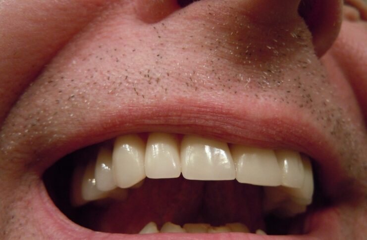 Il farmaco che fa ricrescere i denti può arrivare nel 2030