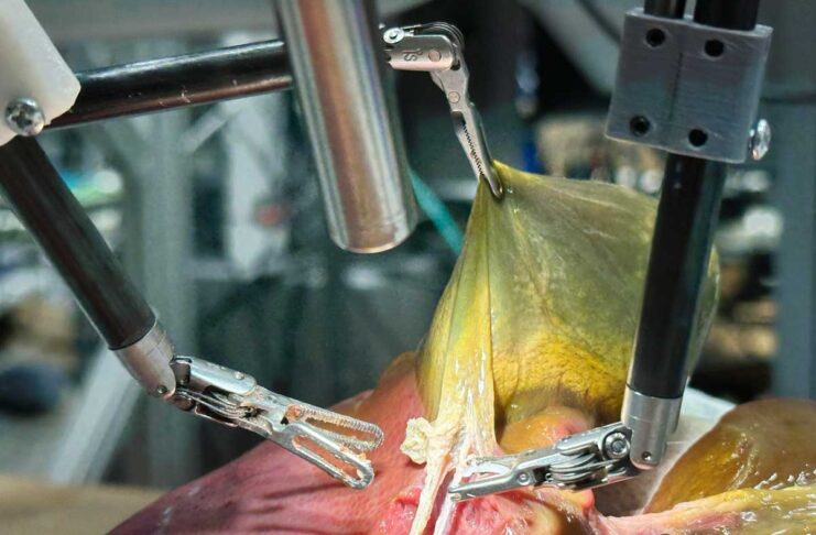 Un robot ha eseguito un intervento di colecistectomia in autonomia grazie all'AI - macitynet.it