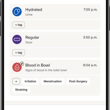 La telecamera per WC Kohler è la dashcam per la salute intestinale - macitynet.it