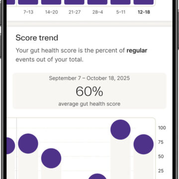 La telecamera per WC Kohler è la dashcam per la salute intestinale - macitynet.it