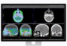 Apple Studio Display XDR ottimizzato per diagnostica medica con DICOM Apple Studio Display XDR è ottimizzato DICOM per la radiologia digitale - macitynet.it