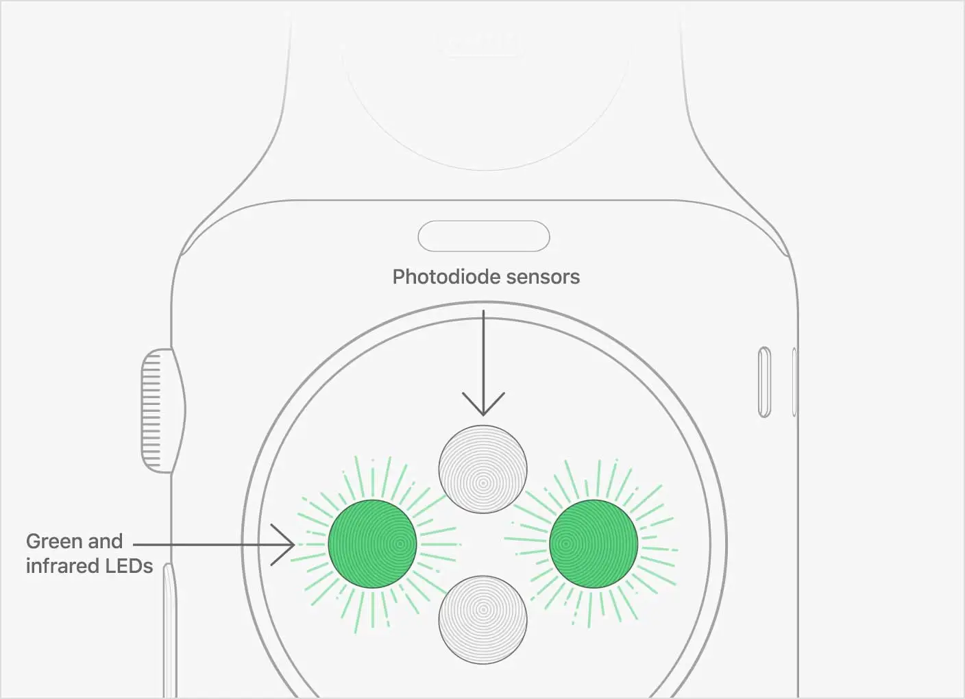 Apple Watch, uomo salvato dopo la segnalazione di anomalie nel suo battito cardiaco