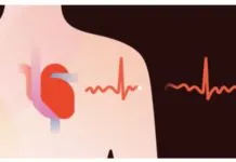 I futuri iPhone si sbloccheranno… con il cuore Prevenzione della fibrillazione atriale con Apple Watch: più di 4.300 ECG in due giorni